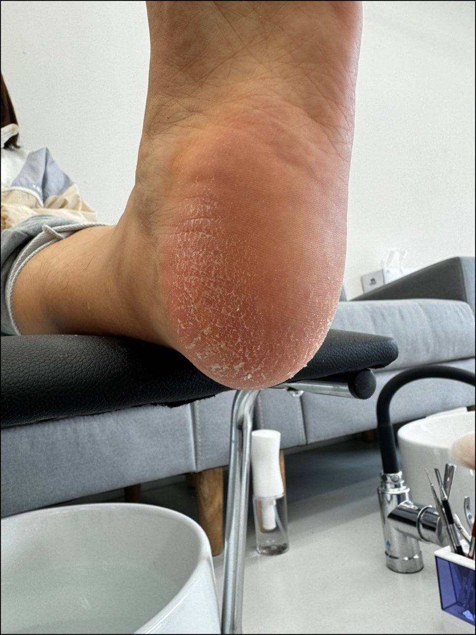 무드비네일닥터아이티엔내성발톱무좀발각질 이미지