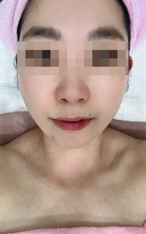임미선헤어스킨바디 이미지