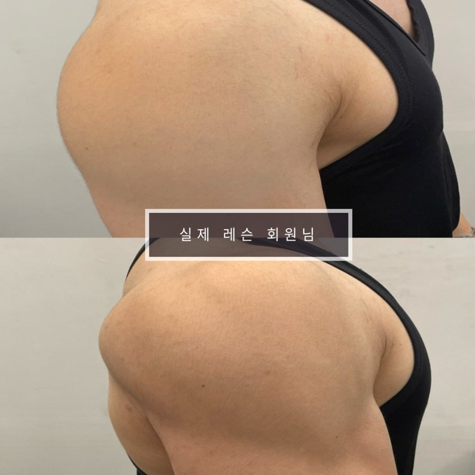 바이칼휘트니스 이미지