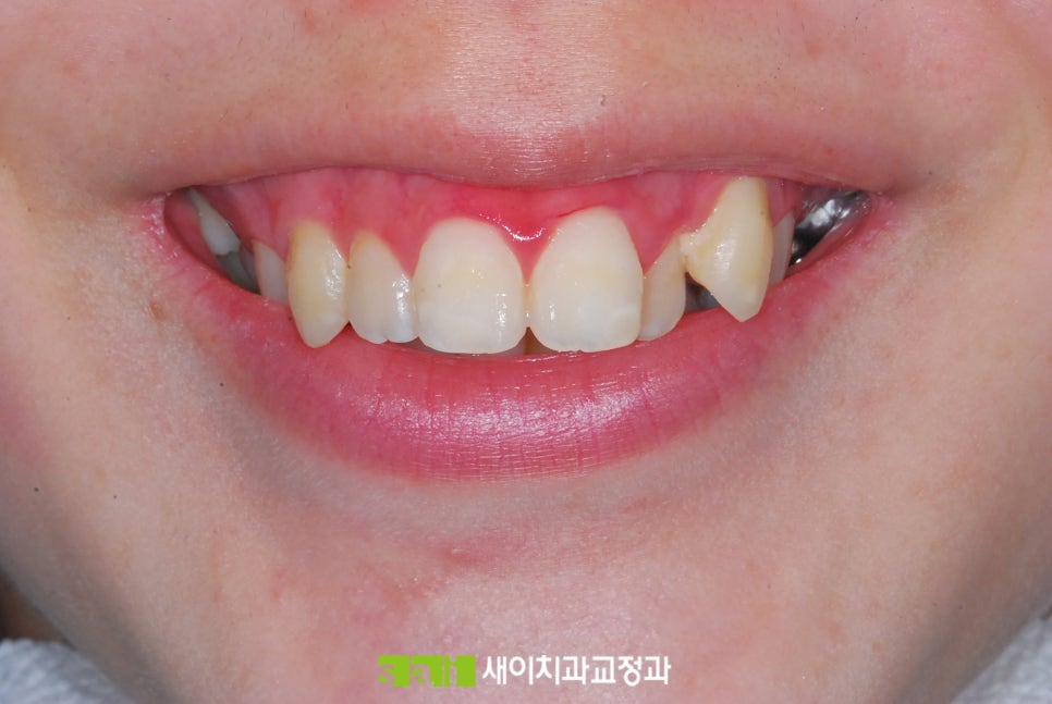 새이치과교정과치과의원 이미지
