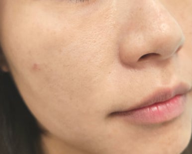 타이팅 메디케어 스킨앤바디 이미지