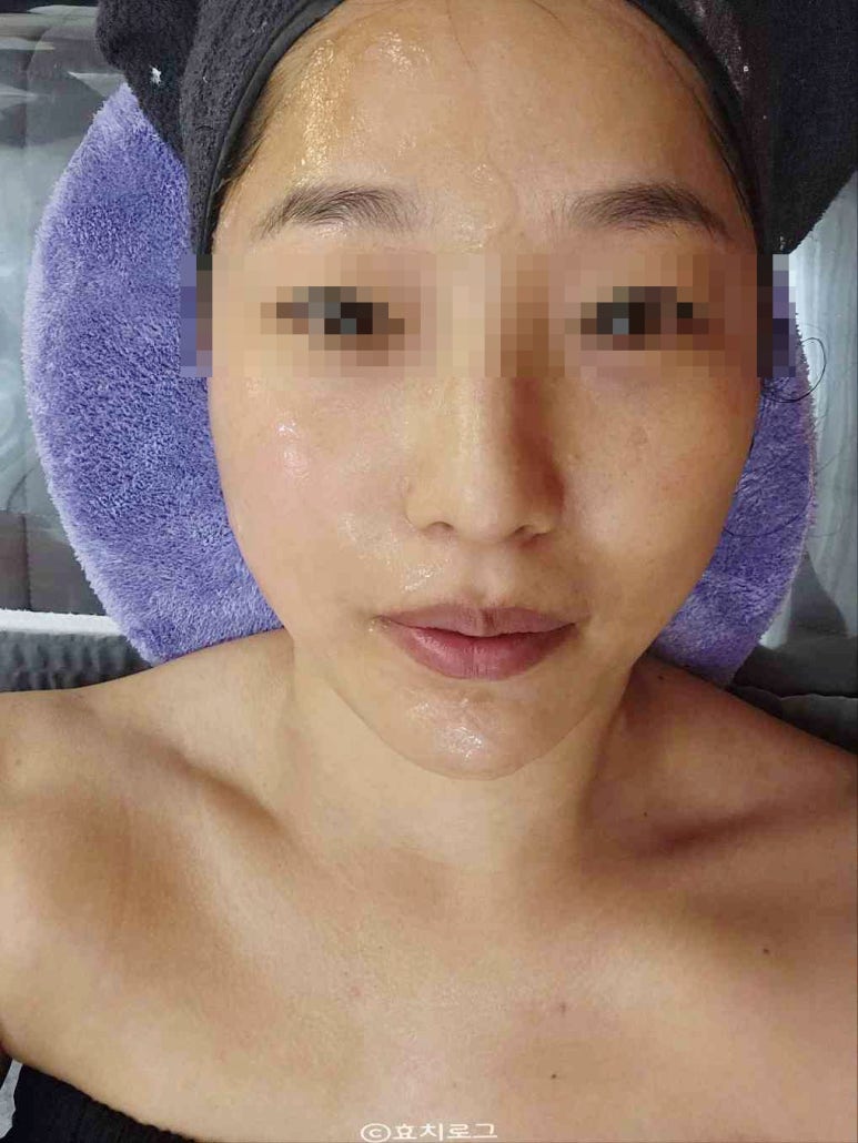 스킨바 수지성복점 이미지