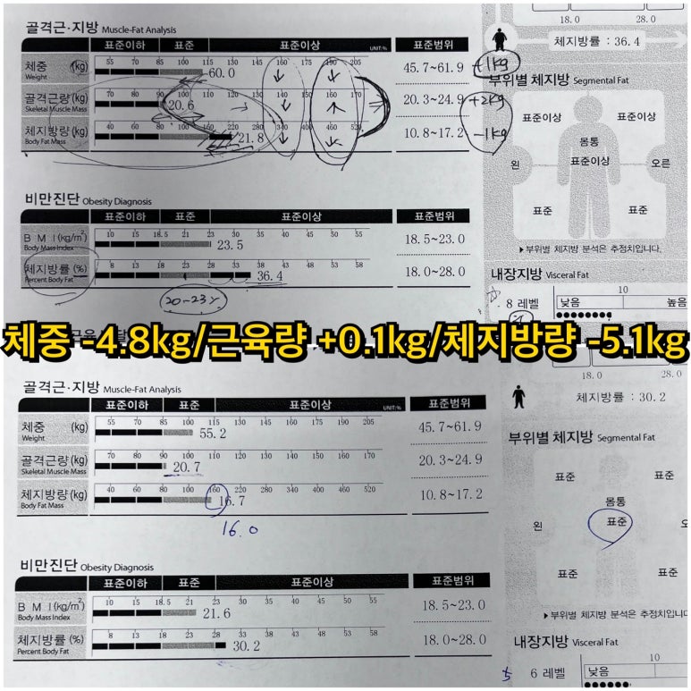 리본짐 이미지