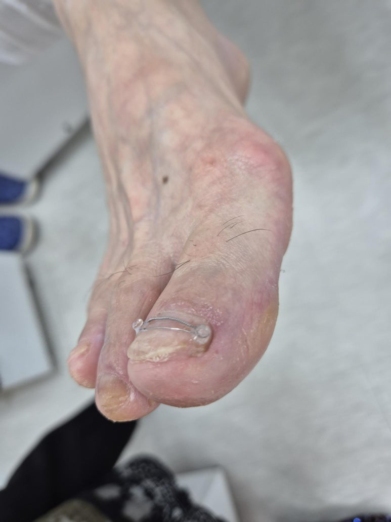 네일그리심 이미지
