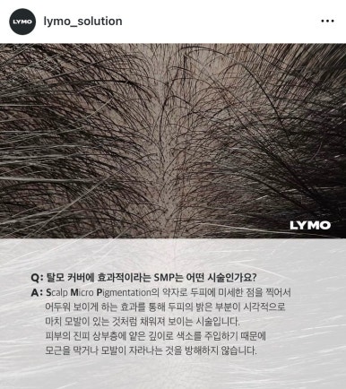 라이모 이미지