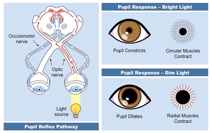 의식 사정 MSE GCS RASS CAM-ICU Pupil light reflex : 네이버 블로그