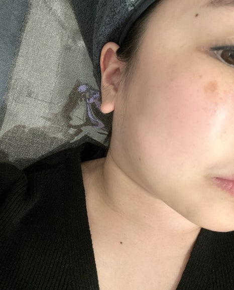 밴스의원일산 이미지
