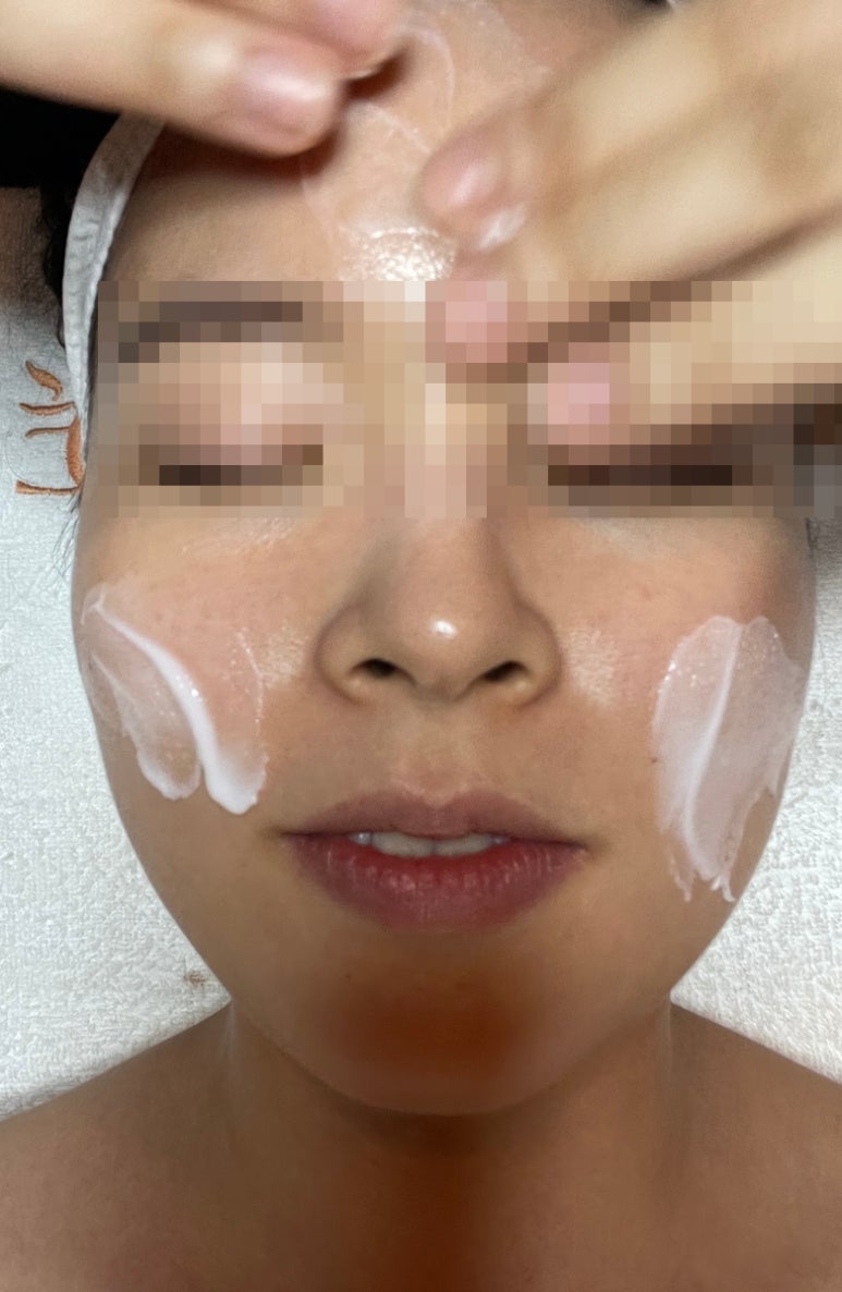 스파로제 이미지