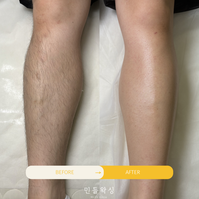 민들왁싱 이미지