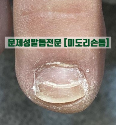 그레이스네일살롱 이미지