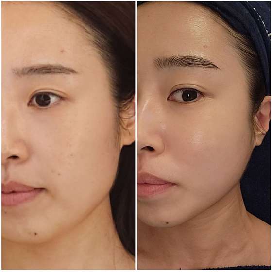 아이오마끌레르 이미지