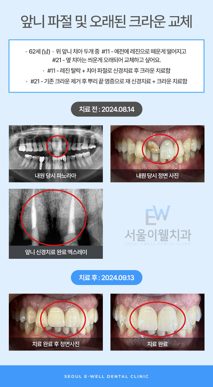 가까운치과 이미지