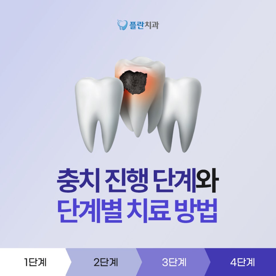 플란부평 이미지