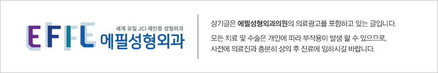 에필성형외과의원 이미지
