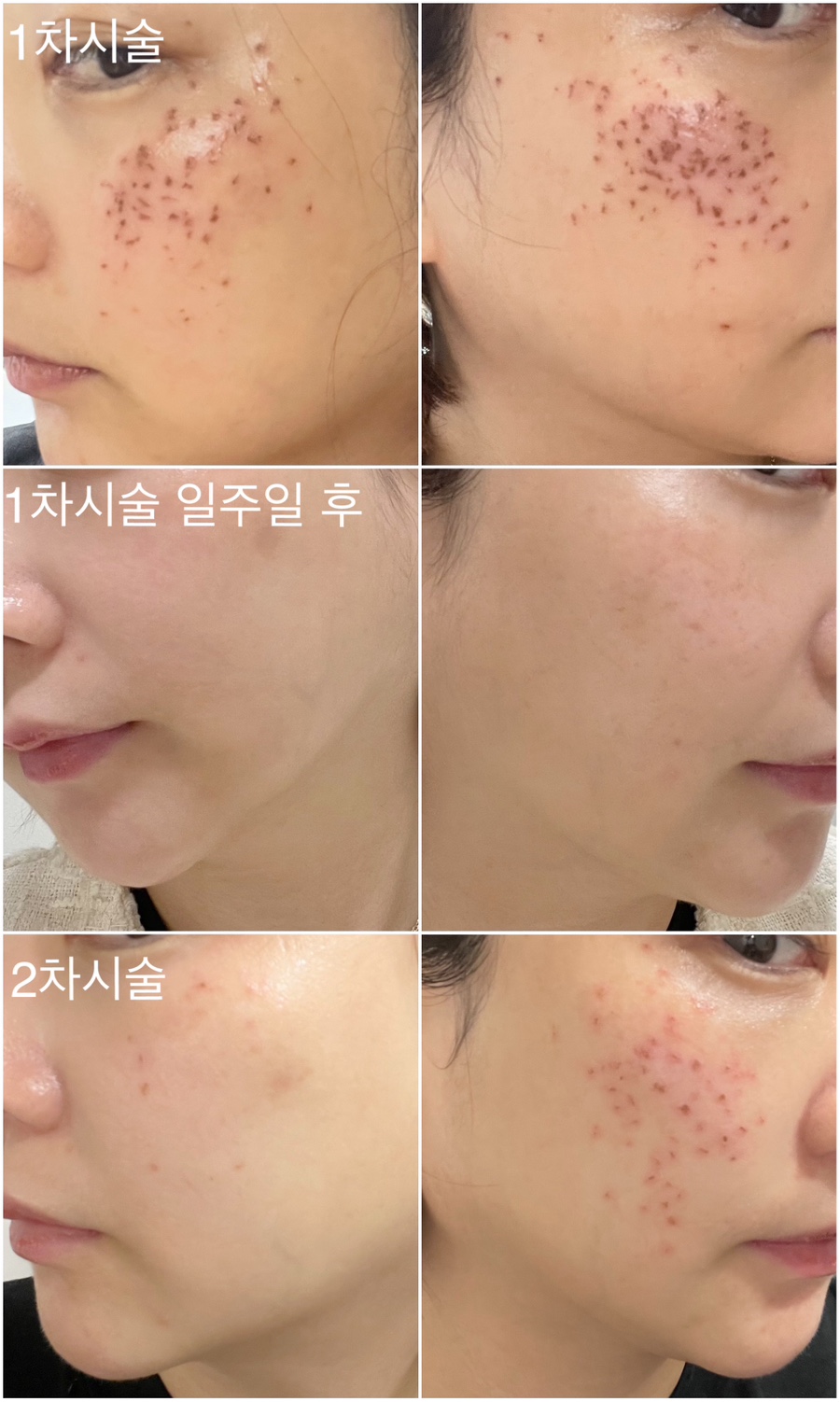 제이엘뷰티 이미지