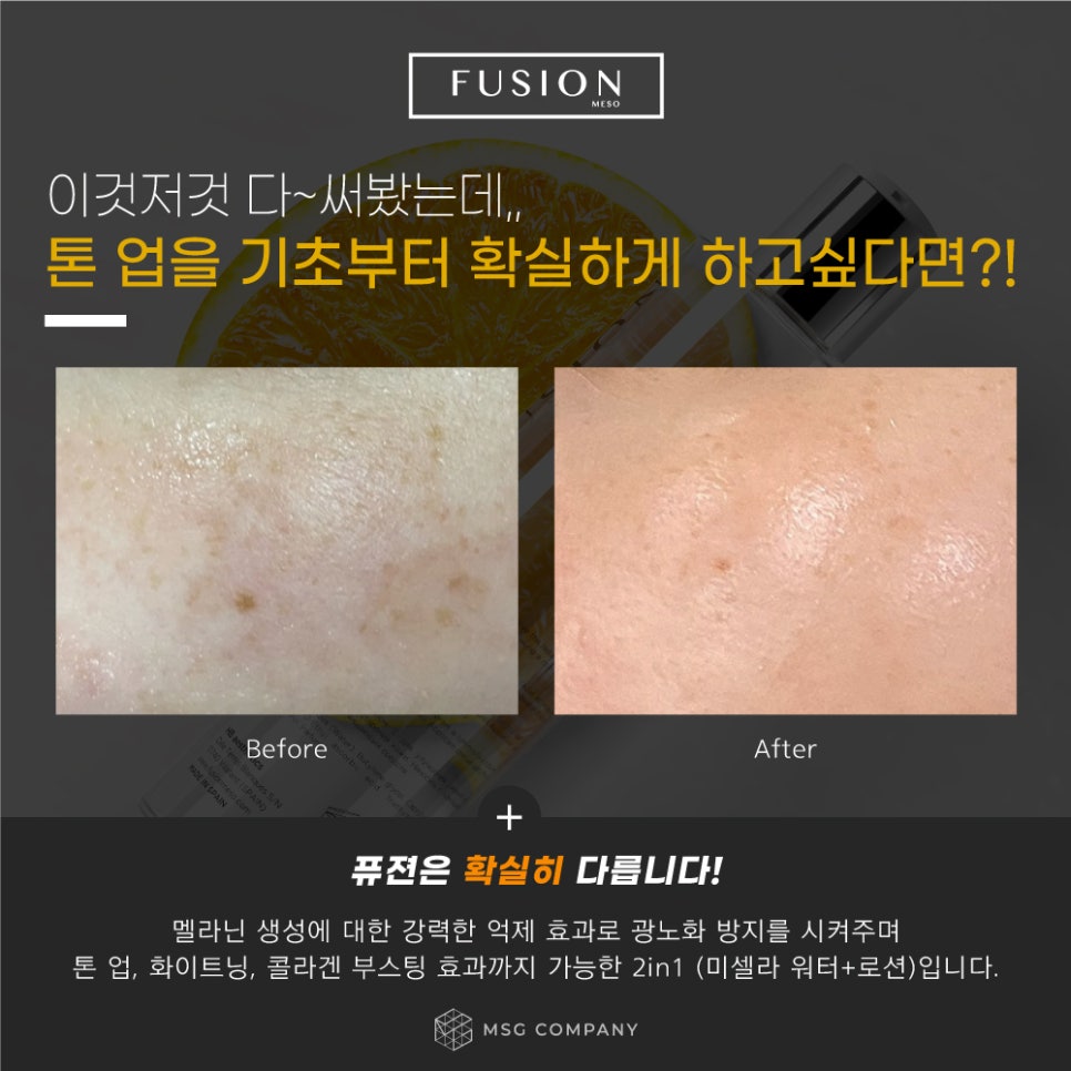 엠에스지 컴퍼니 이미지