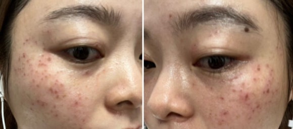 뷰티라운지강서 이미지