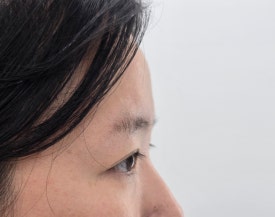 오늘도;예쁜EYE 이미지