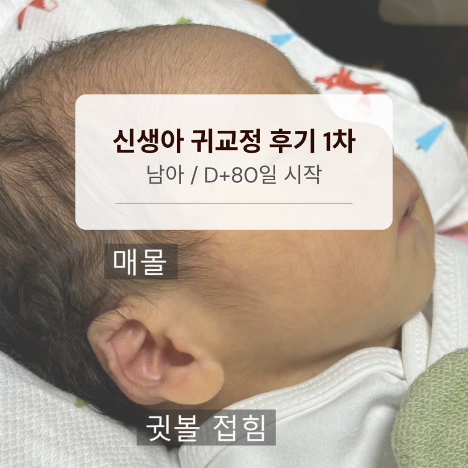 엔젤아이의원 이미지