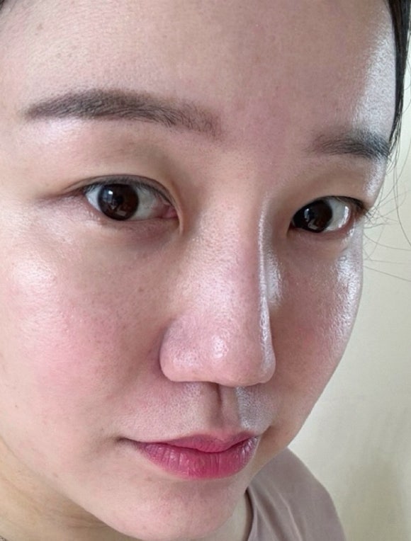 엘뷰티의원 이미지