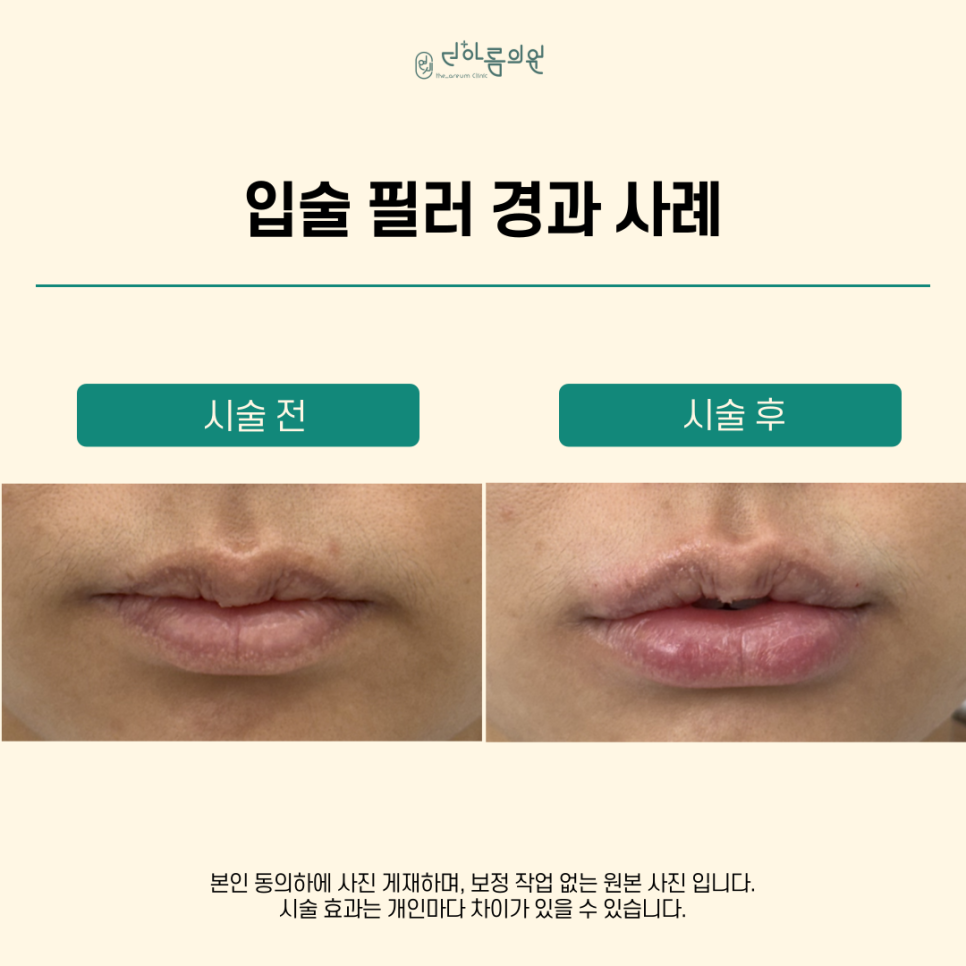 연세더아름의원 이미지