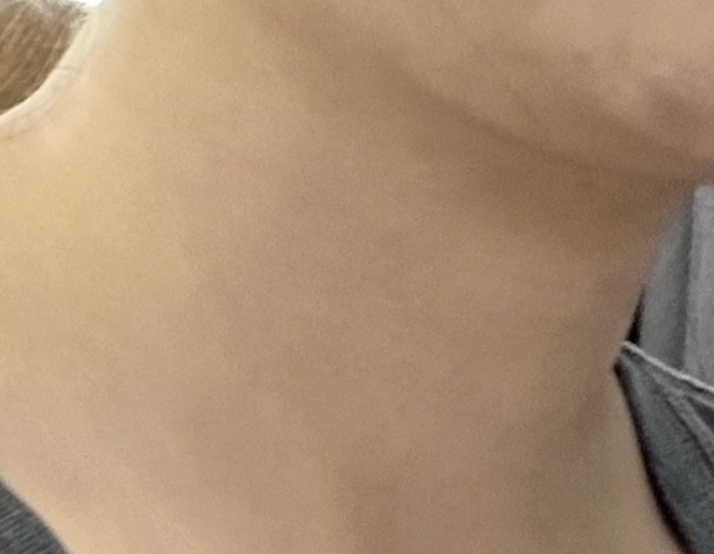 일석이조홈케어 이미지