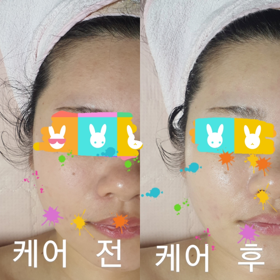 피부관리 이미지