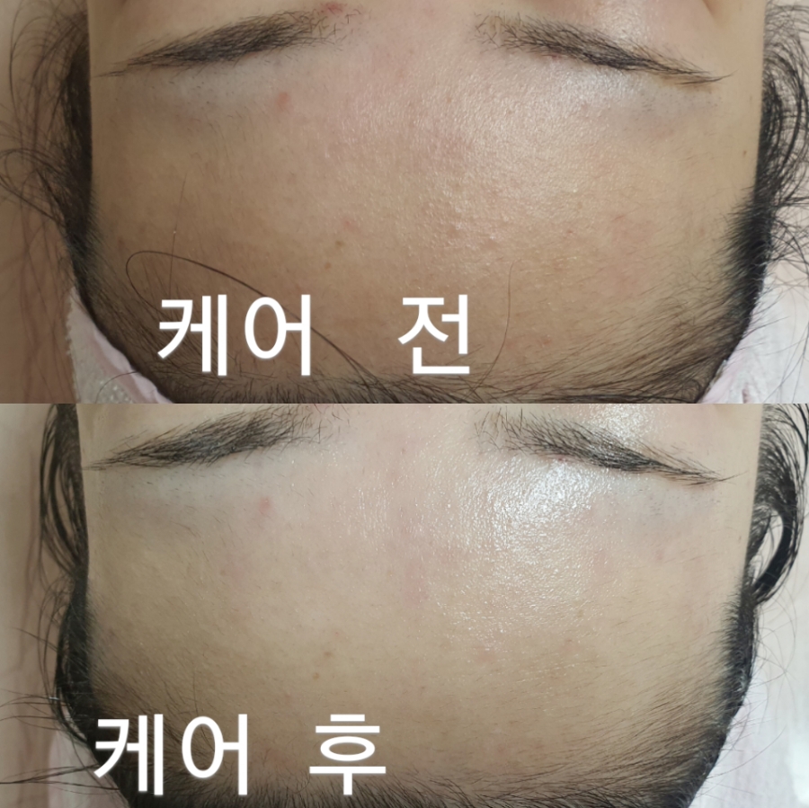 에스테라피 이미지