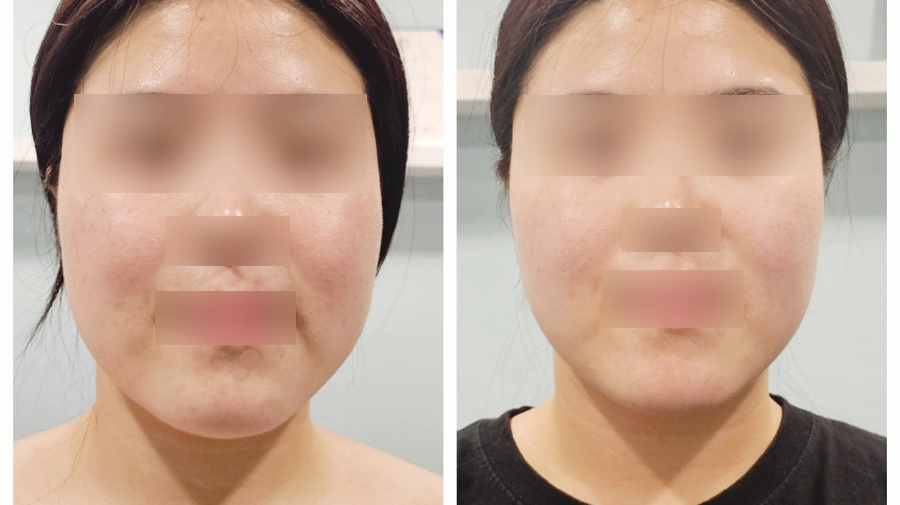 더바른테라피 이미지