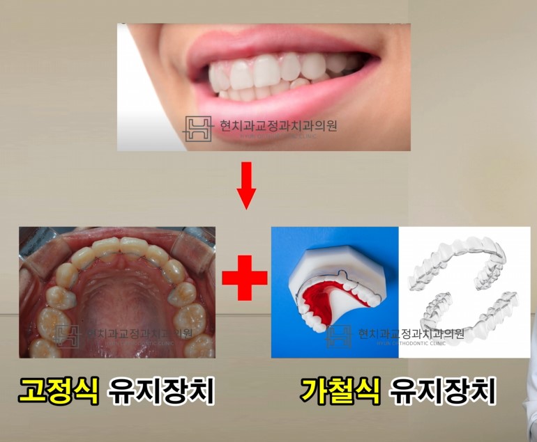 현치과교정과치과의원 이미지