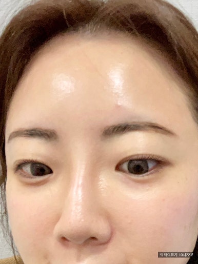브로우올리 이미지