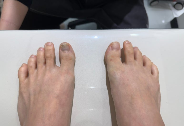 순쓰네일 이미지