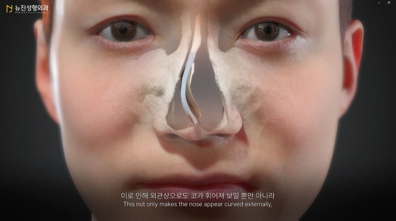 뉴진성형외과 이미지