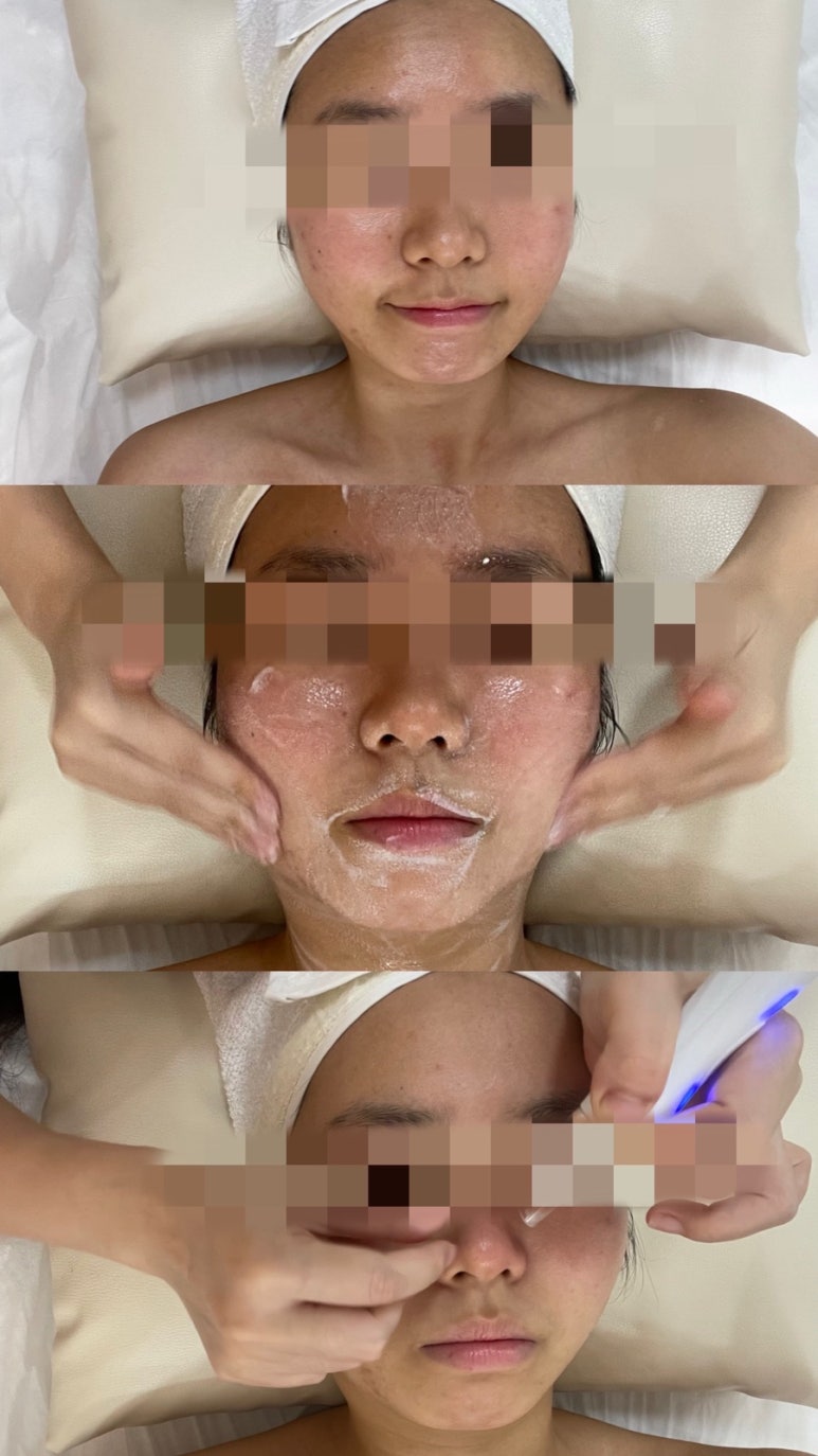 하영피부관리 이미지