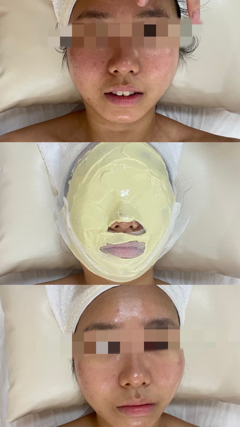 하영피부관리 이미지