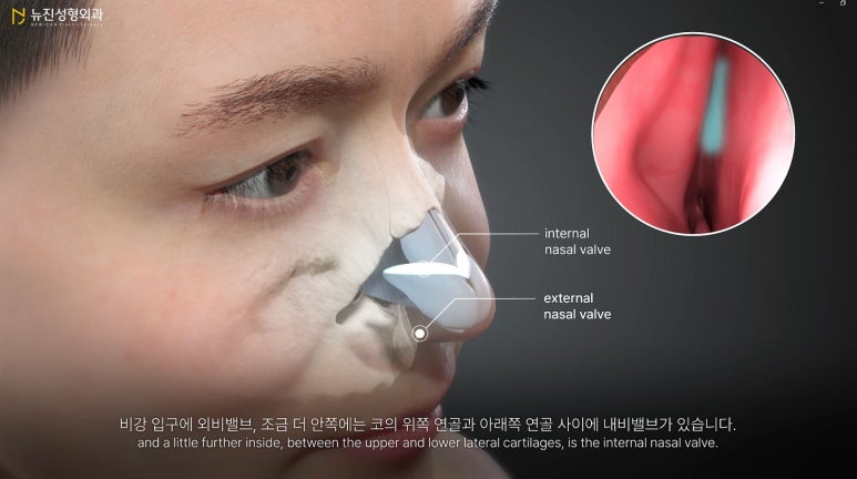 뉴진성형외과 이미지