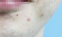 리츠피부과의원 이미지
