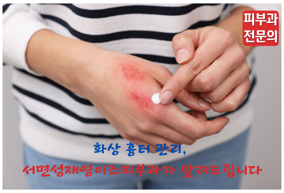 성재영이즈피부과 이미지