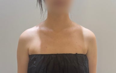 하이퍼무드 이미지