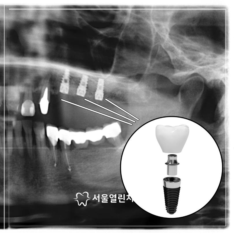 더열린치과의원 이미지