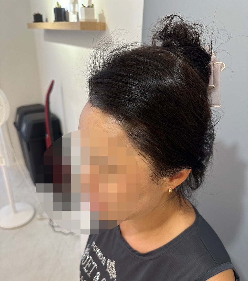 진헤어라인 이미지