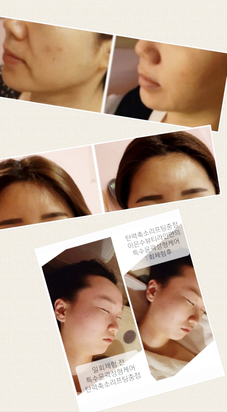 뷰티라인 이미지