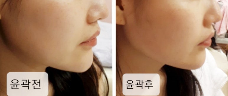 뷰티라인 이미지