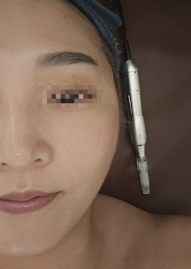 바른선 테라피 이미지
