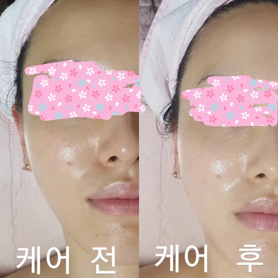 에스테라피 이미지