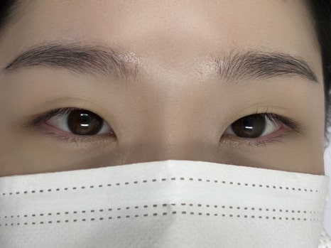 로로아로 이미지