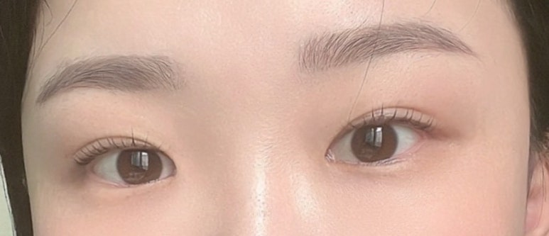 넌눈이예뻐 이미지