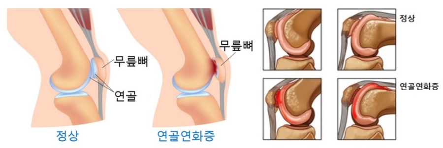 연화케어 이미지