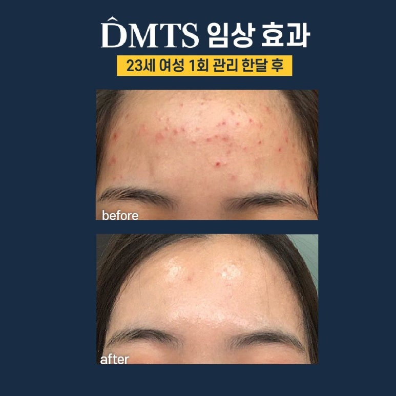 피부,맑음 이미지