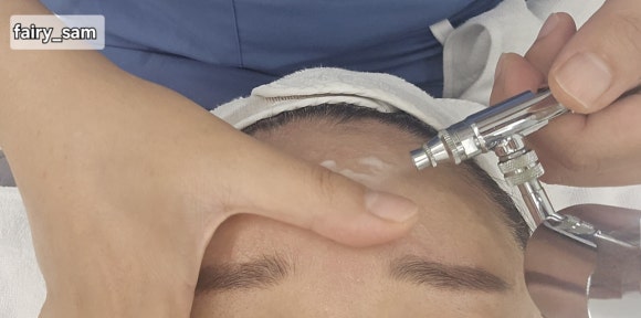 정원장의 모공세척테라피 이미지